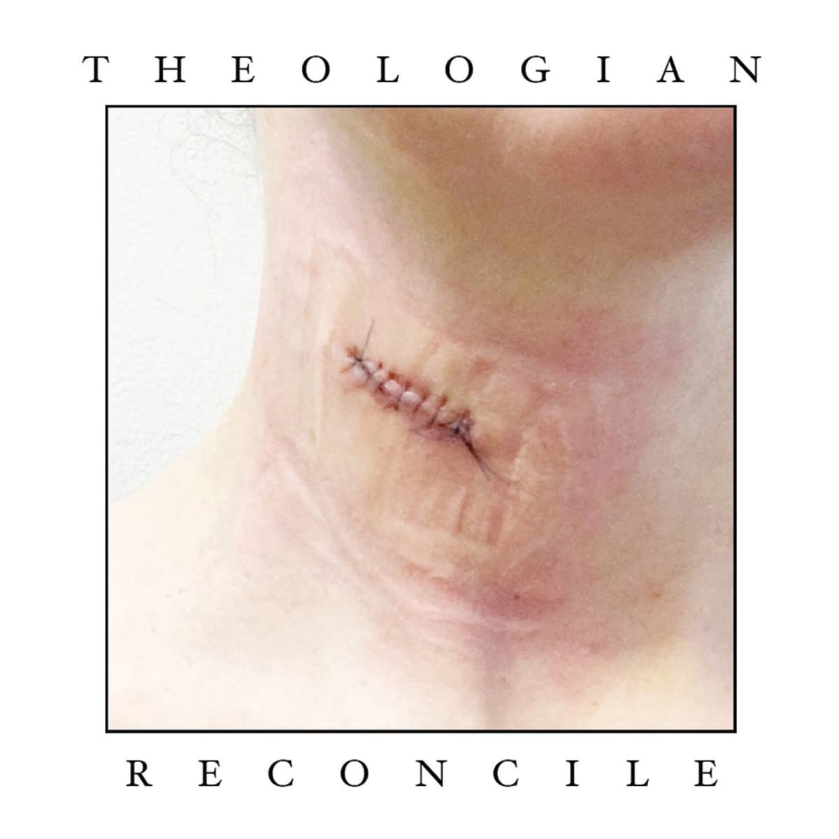 Reconcile