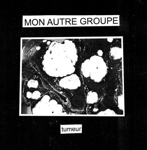 Tumeur
