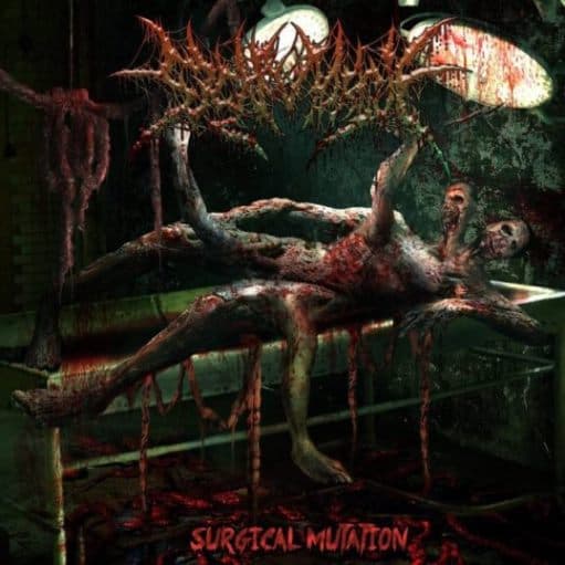 Surgical Mutation