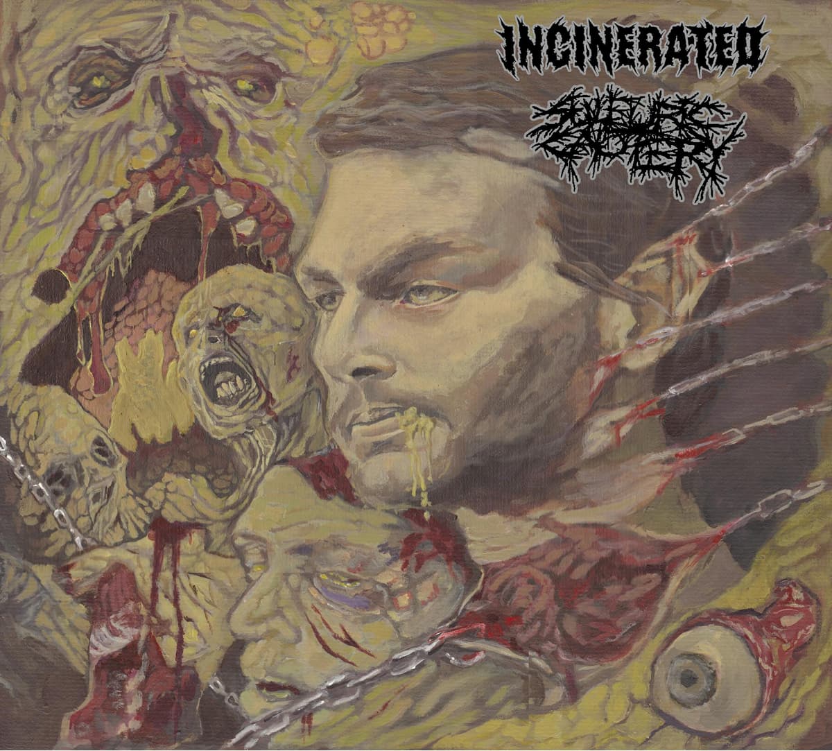 Incinerated / Sulfuric Cautery