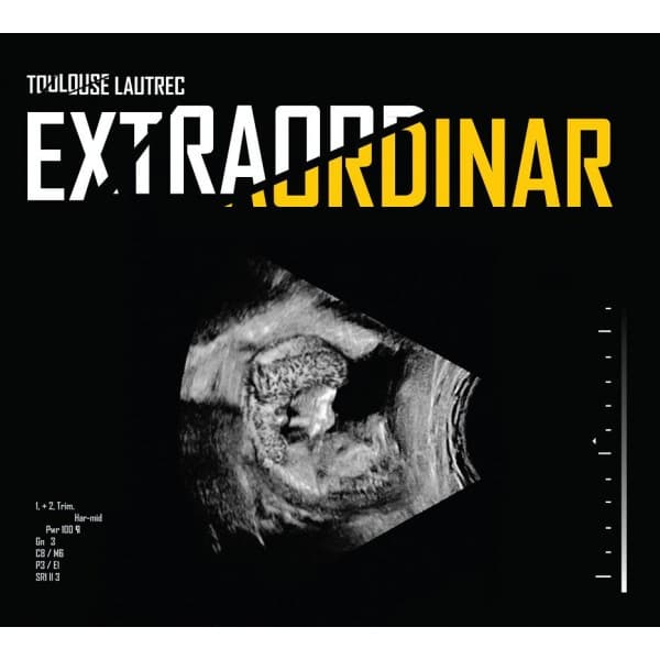 Extraordinar