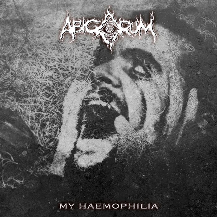 My Haemophilia