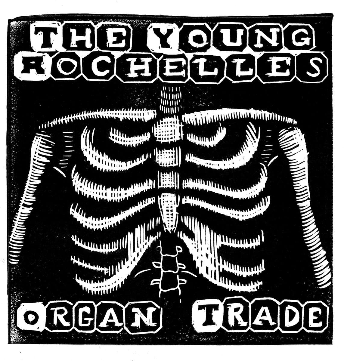 Organ Trade
