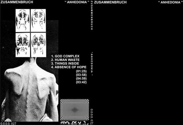 Anhedonia