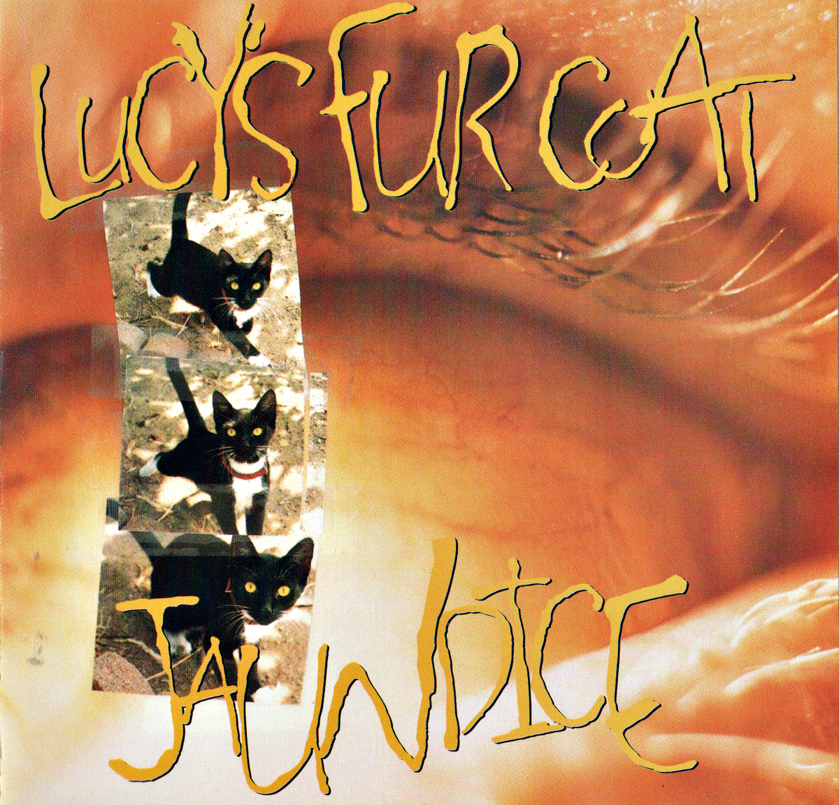 Jaundice