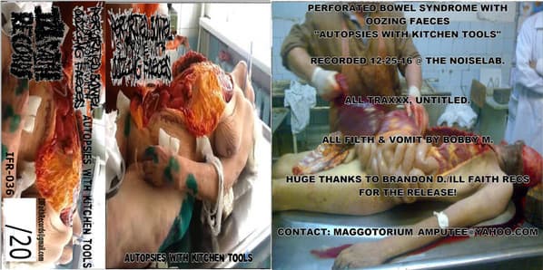 Autopsies With Kitchen Tools