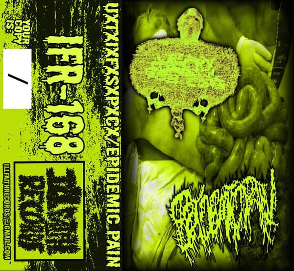 UxTxIxFxSxPxCx / Epidemic Pain
