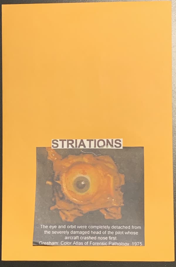 Striations