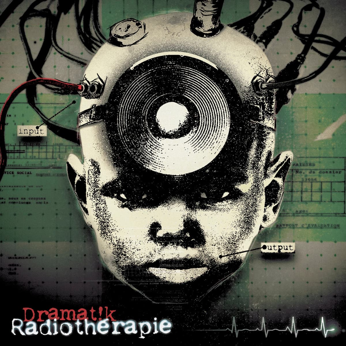 Radiothérapie