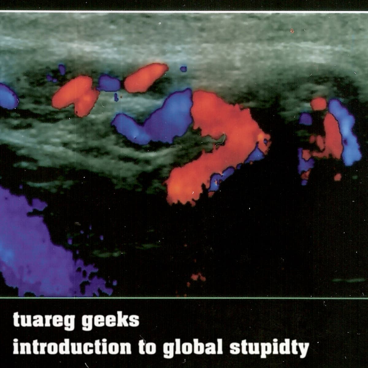 Introduction to Global Stupidity