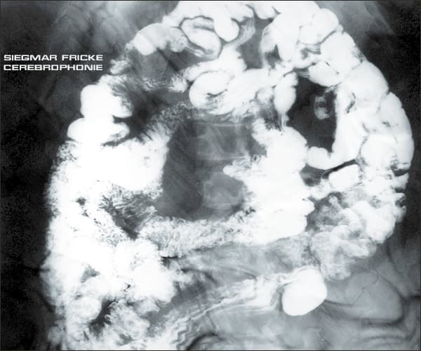 Cerebrophonie