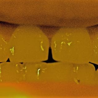 Azul, mis dientes