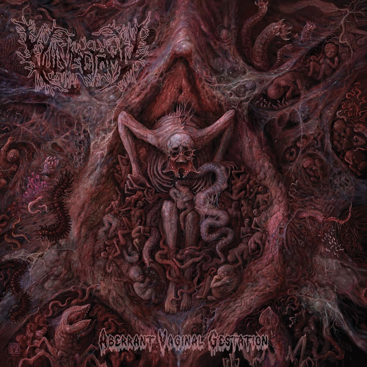 Aberrant Vaginal Gestation