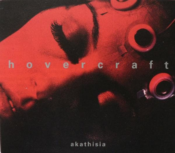 Akathisia