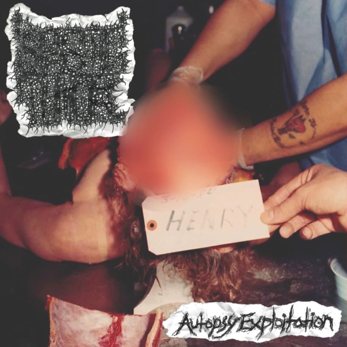 Autopsy Exploitation