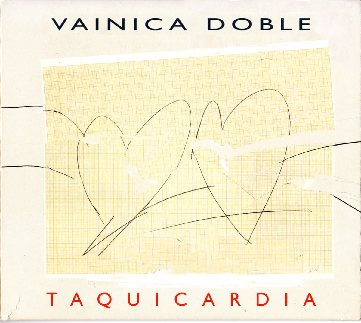 Taquicardia