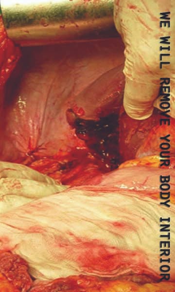 We Will Remove Your Body Interior